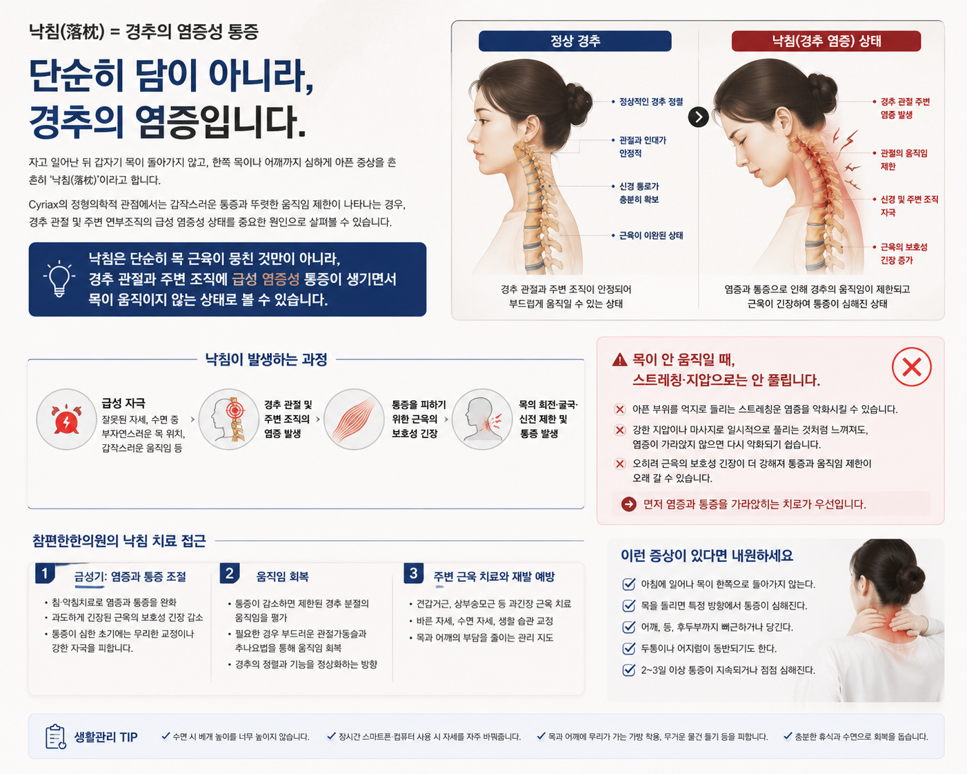 낙침에서 경추 통증과 보호성 근육 긴장, 움직임 제한을 설명하는 의료 인포그래픽